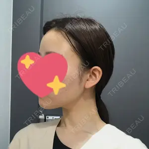 ボンディ美容整形外科（旧リオン整形外科）口コミ