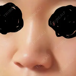 マーブル整形外科口コミ