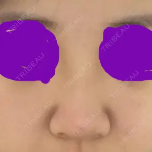 マーブル整形外科口コミ