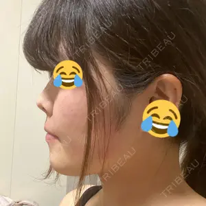 リッツ美容外科の口コミ