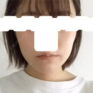 TCB東京中央美容外科 TCB東京中央美容外科 新宿東口院口コミ