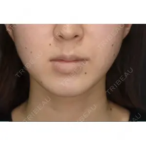 B-LINE CLINIC B-LINE CLINIC 池袋院口コミ