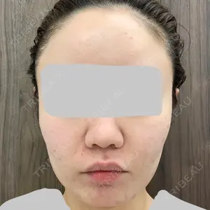 TCB東京中央美容外科 TCB東京中央美容外科 中野院口コミ