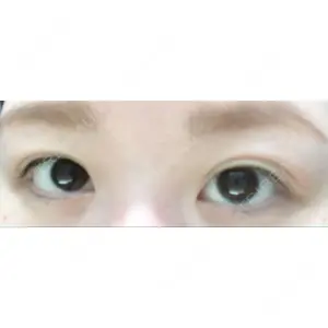 いちのせ形成外科・皮膚科 眼瞼＆フェイスクリニック口コミ