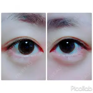 湘南美容クリニック 湘南美容クリニック 宇都宮院口コミ