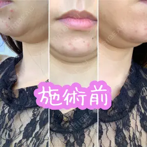 ビスポーククリニック 福岡院の