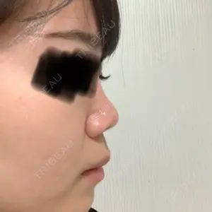FROM B整形外科 (旧バウム整形外科)口コミ