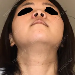 口コミ