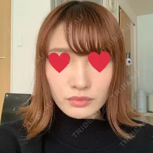 口コミ