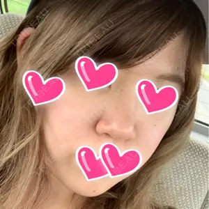 ラミチェ美容整形外科口コミ