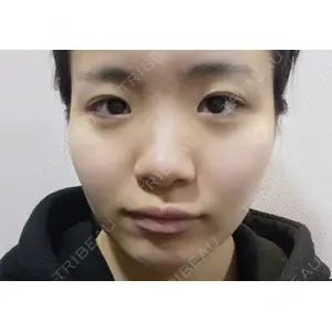 ボンディ美容整形外科（旧リオン整形外科）口コミ