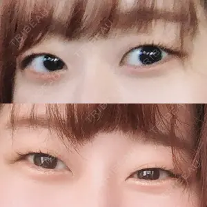 口コミ