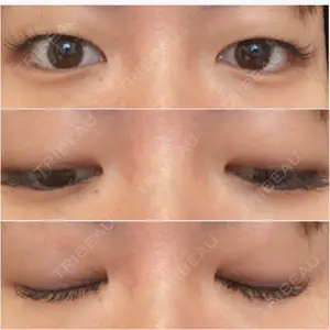 湘南美容クリニック 湘南美容クリニック 東京蒲田院口コミ