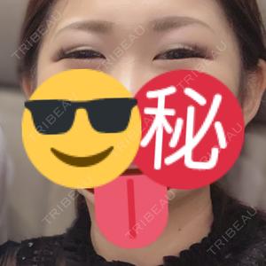 口コミ