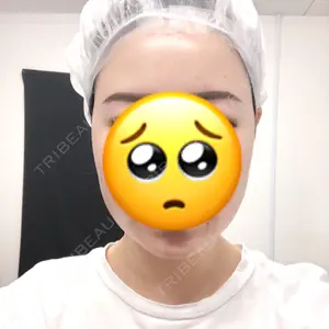 TCB東京中央美容外科 TCB東京中央美容外科 中野院口コミ