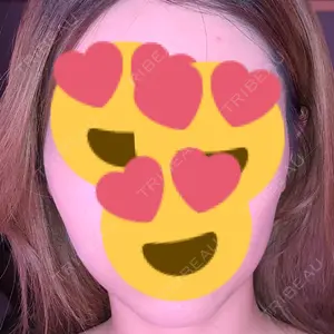 湘南美容クリニック 湘南美容クリニック 名古屋栄院口コミ