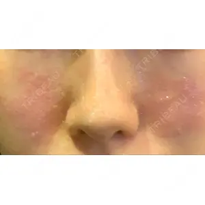 東京皮膚科・形成外科 東京皮膚科・形成外科 (銀座いけだクリニック)口コミ