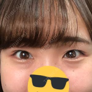 口コミ
