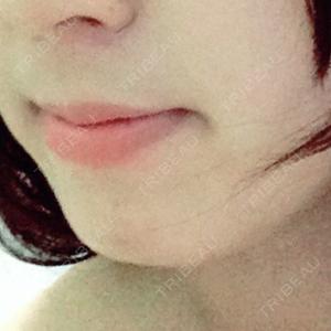 湘南美容クリニック 湘南美容クリニック 名古屋栄院口コミ