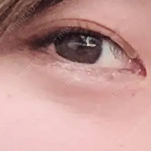 TCB東京中央美容外科 TCB東京中央美容外科 京都駅前院口コミ