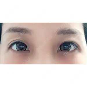 ニドークリニック名古屋口コミ