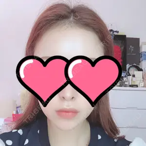TCB東京中央美容外科 TCB東京中央美容外科 中野院口コミ