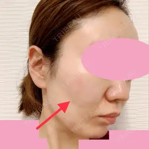 TCB東京中央美容外科 TCB東京中央美容外科 中野院口コミ