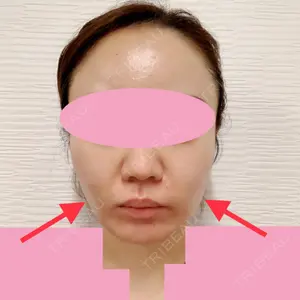TCB東京中央美容外科 TCB東京中央美容外科 中野院口コミ