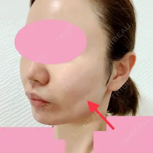 TCB東京中央美容外科 TCB東京中央美容外科 中野院口コミ