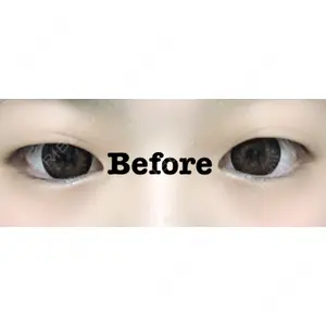 湘南美容クリニック 湘南美容クリニック 赤坂見附院口コミ