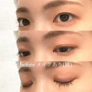 有楽町高野美容クリニック口コミ