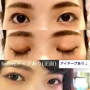 有楽町高野美容クリニック口コミ