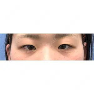 口コミ