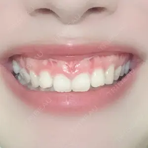 口コミ