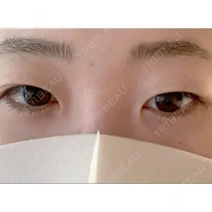 湘南美容クリニック 湘南美容クリニック 東京蒲田院口コミ