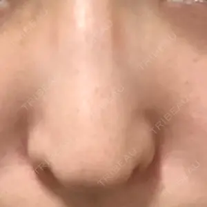HANABI整形外科口コミ