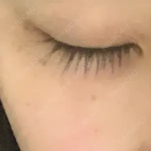 南青山TOKUNAKAクリニック口コミ