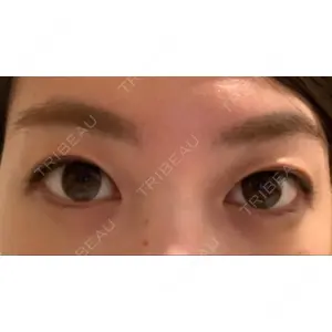湘南美容クリニック 湘南美容クリニック 池袋東口院口コミ