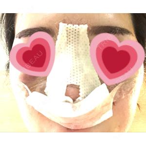 ビーザニュー美容整形外科（旧コノピ美容整形外科）口コミ