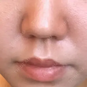 MIYAフェイスクリニックの