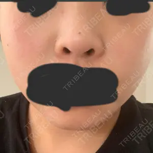 リッツ美容外科 大阪院口コミ