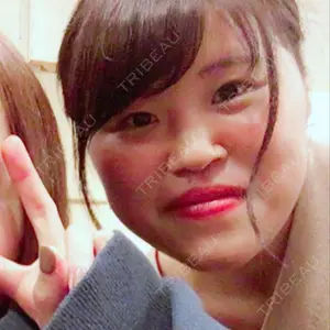 表参道スキンクリニック 表参道スキンクリニック 表参道院口コミ