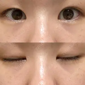 東京イセアクリニック口コミ