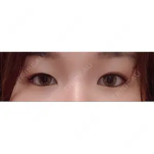 口コミ