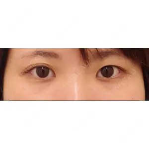 湘南美容クリニック 湘南美容クリニック 東京蒲田院口コミ