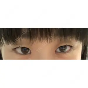 湘南美容クリニック 湘南美容クリニック 宇都宮院口コミ