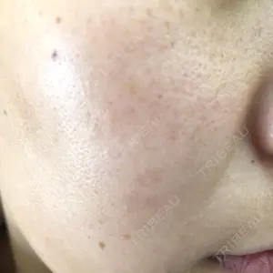 REYOUNGクリニック口コミ