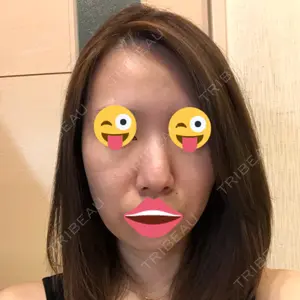 SUEクリニック口コミ