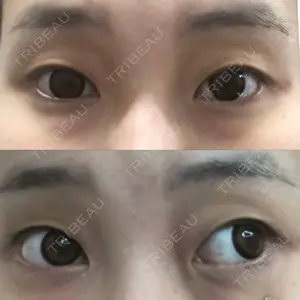 湘南美容クリニック 湘南美容クリニック 熊本院口コミ