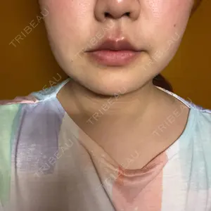 湘南美容クリニック 湘南美容クリニック 新宿本院口コミ